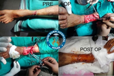 soni-burn-hospital-6
