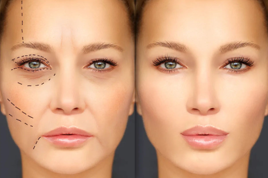 plastic Surgery